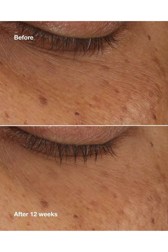 All-About-Eyes-Serum-De-Puffing-Eye-Massage---10-ml