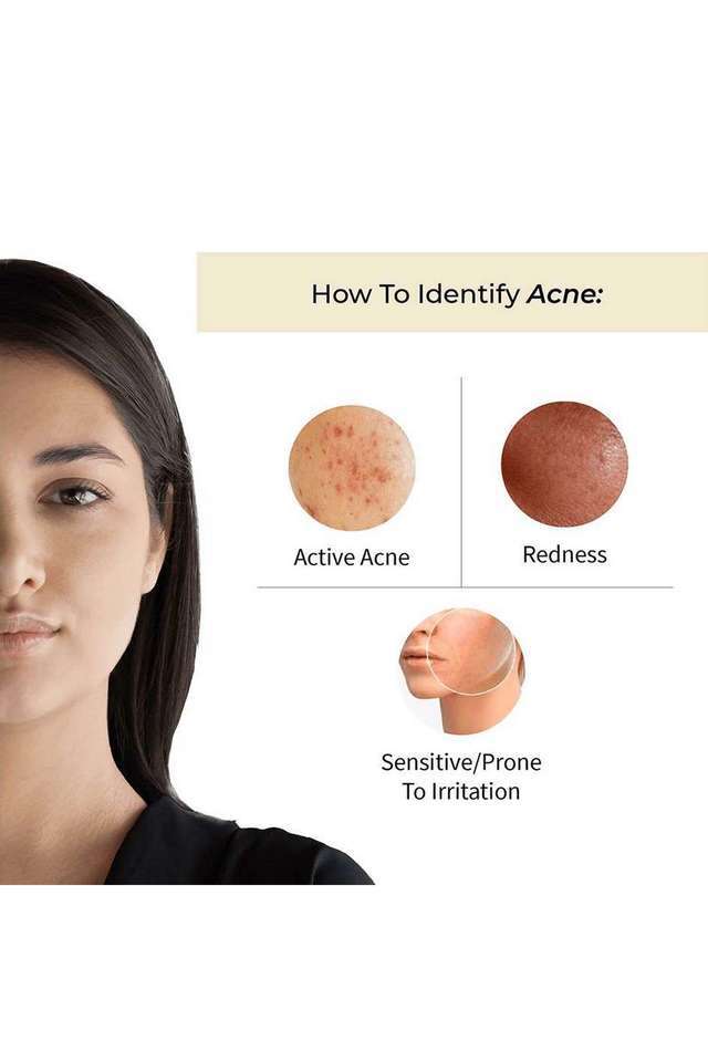 Prakhya-Acne-Rescue-Face-Serum-Vacha-+-Kumari---25-ml